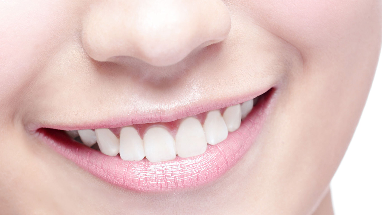 services - teeth whitening